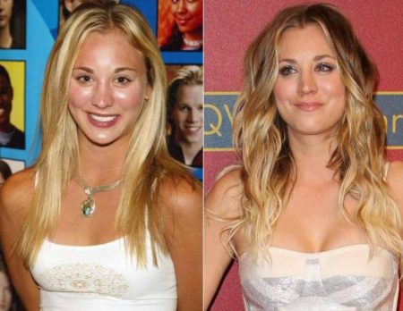 kaley-cuoco-before-and-after-breast-augmentation-3